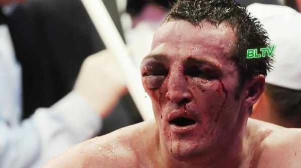 ufc打的最惨烈的比赛？