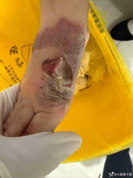 WC！狄龙！突发重伤...